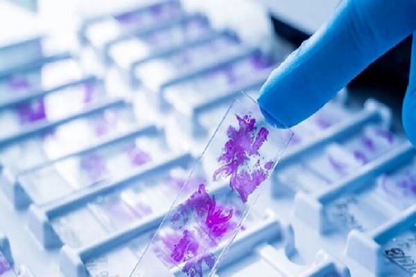 گروهی از محققان یکی از شرکت‌های فناور مستقر در پارک علم و فناوری استان آذربایجان غربی اسکنر لام تشخیصی برای تشخیص سرطان پستان را تجاری‌سازی کردند.